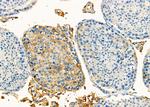 SLC39A6 Antibody in Immunohistochemistry (Paraffin) (IHC (P))