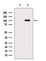 SLC39A6 Antibody in Western Blot (WB)