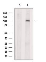 SLC39A6 Antibody in Western Blot (WB)