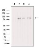 Folliculin Antibody in Western Blot (WB)