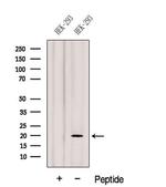 Gemin 6 Antibody in Western Blot (WB)