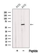 IMPDH1 Antibody in Western Blot (WB)