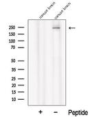 PI4KA Antibody in Western Blot (WB)