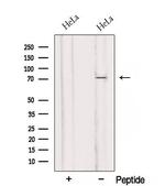 RMI1 Antibody in Western Blot (WB)