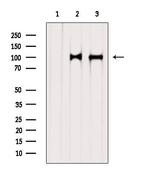 STT3A Antibody in Western Blot (WB)