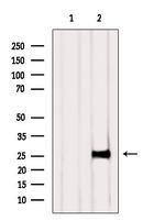 NAA11 Antibody in Western Blot (WB)