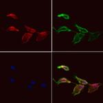 NRDE2 Antibody in Immunocytochemistry (ICC/IF)