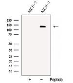 NRDE2 Antibody in Western Blot (WB)