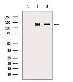 NRDE2 Antibody in Western Blot (WB)