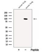 CLGN Antibody in Western Blot (WB)