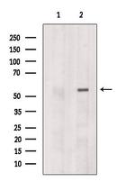 CCT6B Antibody in Western Blot (WB)