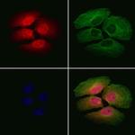 CHMP1A Antibody in Immunocytochemistry (ICC/IF)