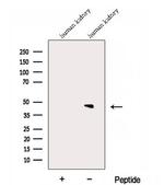 DPEP2 Antibody in Western Blot (WB)