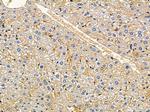 FA2H Antibody in Immunohistochemistry (Paraffin) (IHC (P))