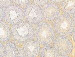 FBLIM1 Antibody in Immunohistochemistry (Paraffin) (IHC (P))