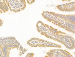 FBLIM1 Antibody in Immunohistochemistry (Paraffin) (IHC (P))