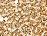 LCA5 Antibody in Immunohistochemistry (Paraffin) (IHC (P))