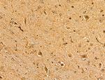 MAP1S Antibody in Immunohistochemistry (Paraffin) (IHC (P))