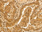 MAP1S Antibody in Immunohistochemistry (Paraffin) (IHC (P))