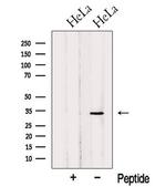 OBFC2B Antibody in Western Blot (WB)