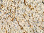 OSBPL10 Antibody in Immunohistochemistry (Paraffin) (IHC (P))