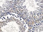 MOB1 Antibody in Immunohistochemistry (Paraffin) (IHC (P))