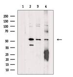 ZNF71 Antibody in Western Blot (WB)