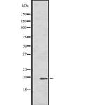 HSPB7 Antibody in Western Blot (WB)