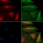 IL36B Antibody in Immunocytochemistry (ICC/IF)