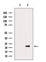 BCL7B Antibody in Western Blot (WB)