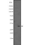 MAGEB5 Antibody in Western Blot (WB)