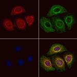 TRIO Antibody in Immunocytochemistry (ICC/IF)