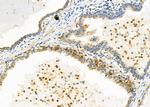 TRIO Antibody in Immunohistochemistry (Paraffin) (IHC (P))