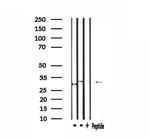 TRIO Antibody in Western Blot (WB)