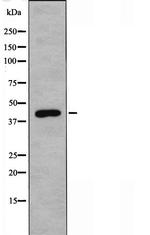 DLX3 Antibody in Western Blot (WB)