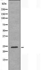 HOXA7 Antibody in Western Blot (WB)