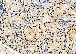 PRKAR1B Antibody in Immunohistochemistry (Paraffin) (IHC (P))