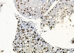 PRKAR1B Antibody in Immunohistochemistry (Paraffin) (IHC (P))