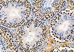 PRKAR1B Antibody in Immunohistochemistry (Paraffin) (IHC (P))