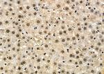 PRKAR1B Antibody in Immunohistochemistry (Paraffin) (IHC (P))