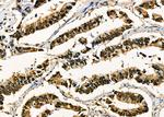 PRKAR1B Antibody in Immunohistochemistry (Paraffin) (IHC (P))