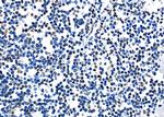 PRKAR1B Antibody in Immunohistochemistry (Paraffin) (IHC (P))