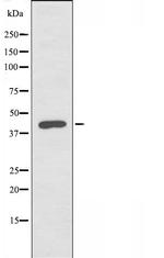 PRKAR1B Antibody in Western Blot (WB)