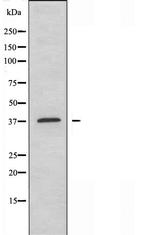 EFNA3 Antibody in Western Blot (WB)