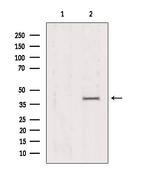 AMPK gamma-1,2,3 Antibody in Western Blot (WB)