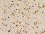 PITX1 Antibody in Immunohistochemistry (Paraffin) (IHC (P))