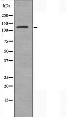 MN1 Antibody in Western Blot (WB)