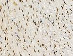 PPP1R14C Antibody in Immunohistochemistry (Paraffin) (IHC (P))