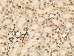 PPP1R14C Antibody in Immunohistochemistry (Paraffin) (IHC (P))