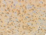 SMG7 Antibody in Immunohistochemistry (Paraffin) (IHC (P))